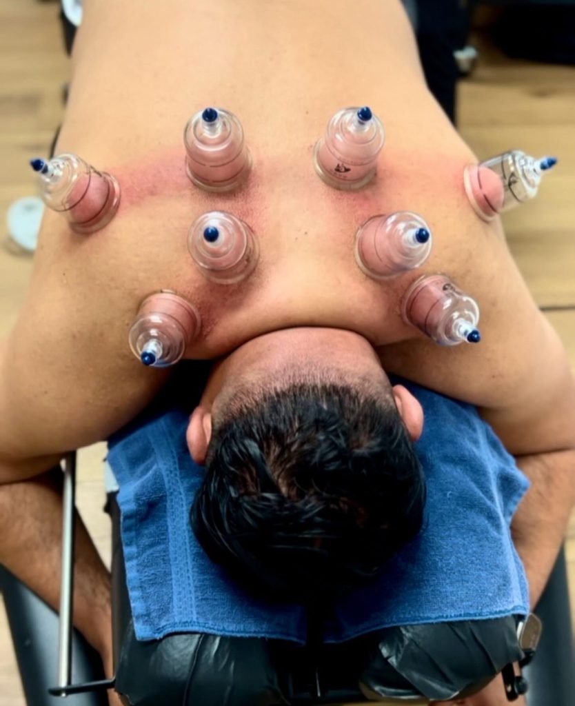 Upper Cross Syndrome